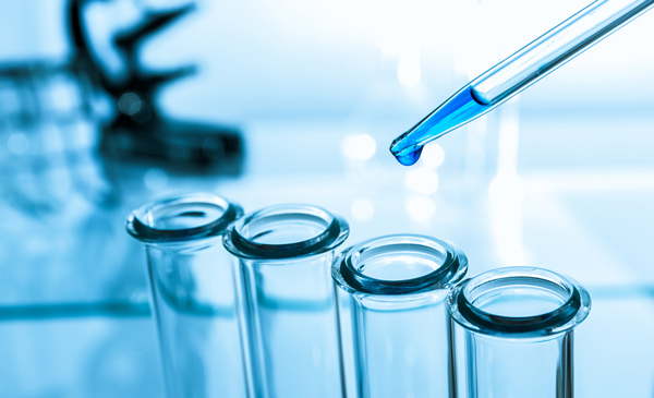 GİMDES Laboratuvar Analizlerinde Haziran-Ağustos Ayı Raporları